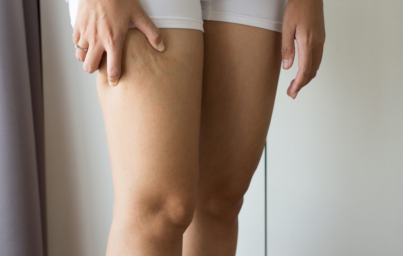 Tratamiento para celulitis o piel de naranja
